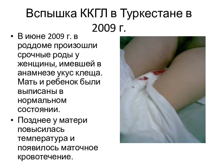 Вспышка ККГЛ в Туркестане в 2009 г. В июне 2009 г.