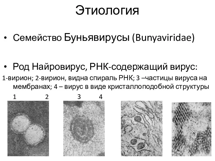 Этиология Семейство Буньявирусы (Bunyaviridae) Род Найровирус, РНК-содержащий вирус: 1-вирион; 2-вирион, видна