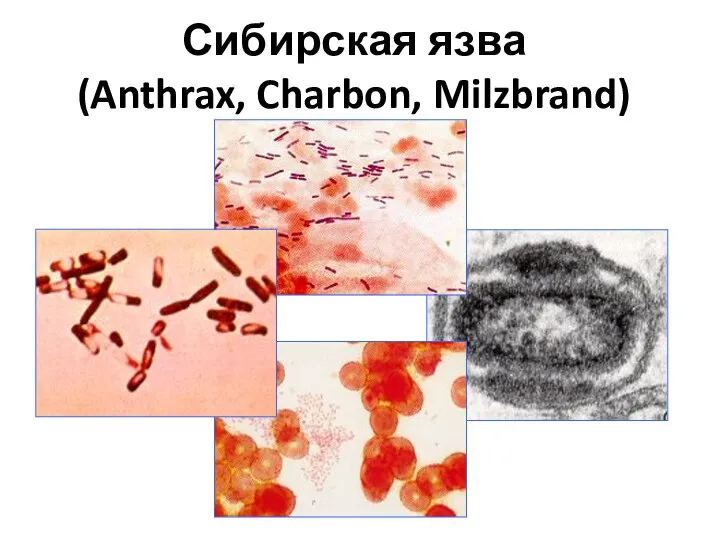 Сибирская язва (Anthrax, Charbon, Milzbrand)