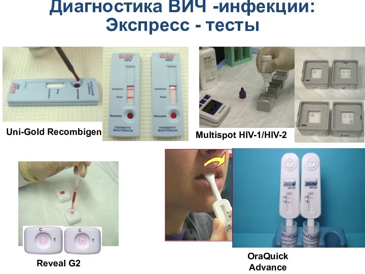 Uni-Gold Recombigen Multispot HIV-1/HIV-2 Reveal G2 OraQuick Advance Диагностика ВИЧ -инфекции: Экспресс - тесты