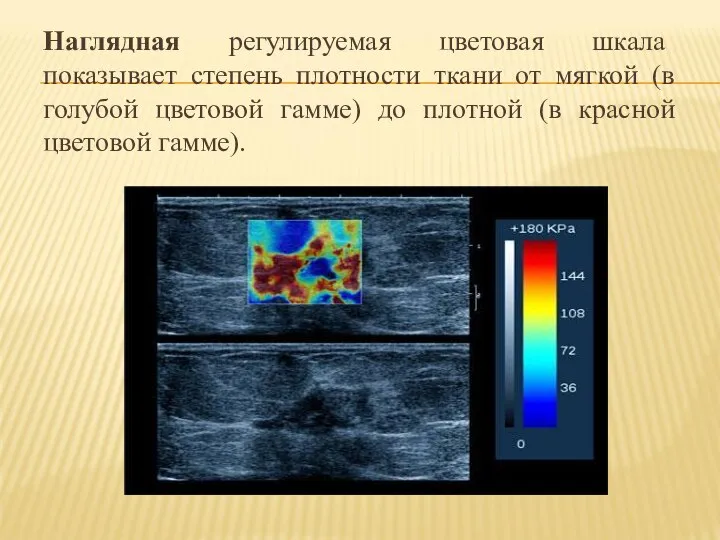 Наглядная регулируемая цветовая шкала показывает степень плотности ткани от мягкой (в