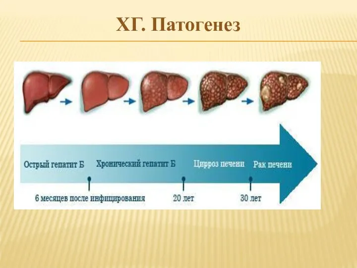 ХГ. Патогенез