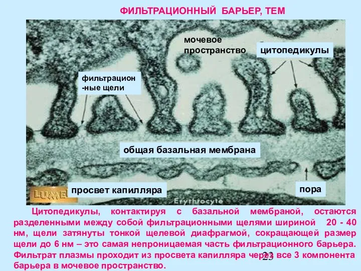 Цитопедикулы, контактируя с базальной мембраной, остаются разделенными между собой фильтрационными щелями