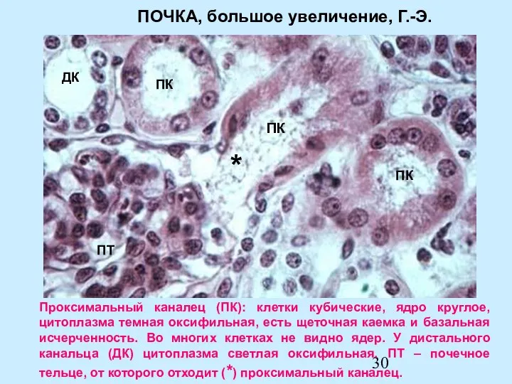Проксимальный каналец (ПК): клетки кубические, ядро круглое, цитоплазма темная оксифильная, есть