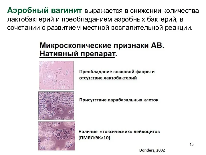 Аэробный вагинит выражается в снижении количества лактобактерий и преобладанием аэробных бактерий,