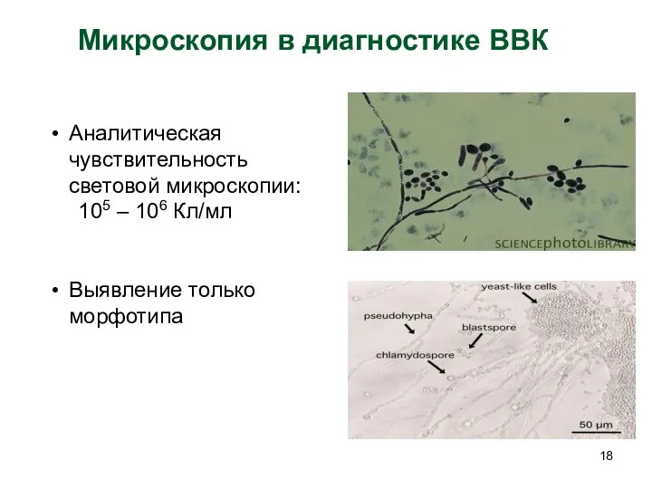 Микроскопия в диагностике ВВК Аналитическая чувствительность световой микроскопии: 105 – 106 Кл/мл Выявление только морфотипа