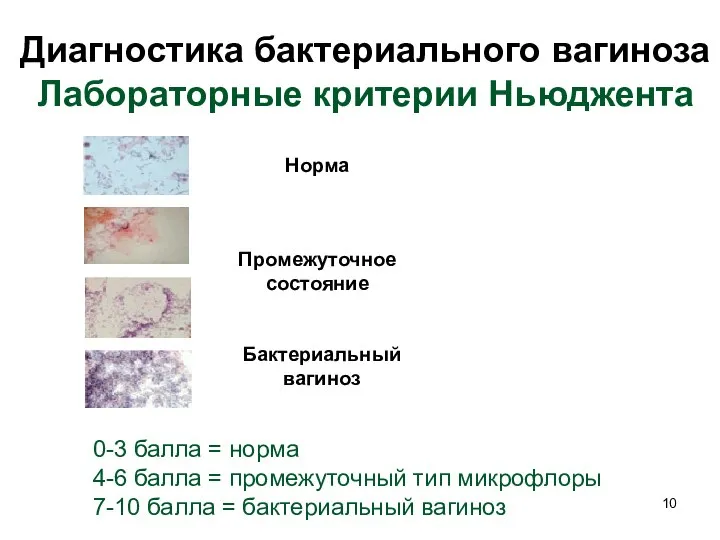 Диагностика бактериального вагиноза Лабораторные критерии Ньюджента Норма Промежуточное состояние Бактериальный вагиноз