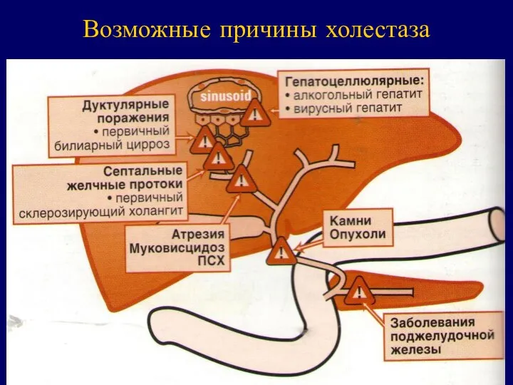 Возможные причины холестаза