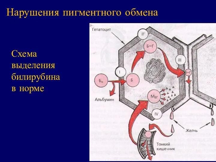 Схема выделения билирубина в норме Нарушения пигментного обмена