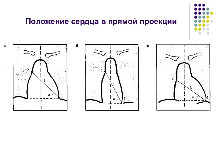 Положение сердца в прямой проекции