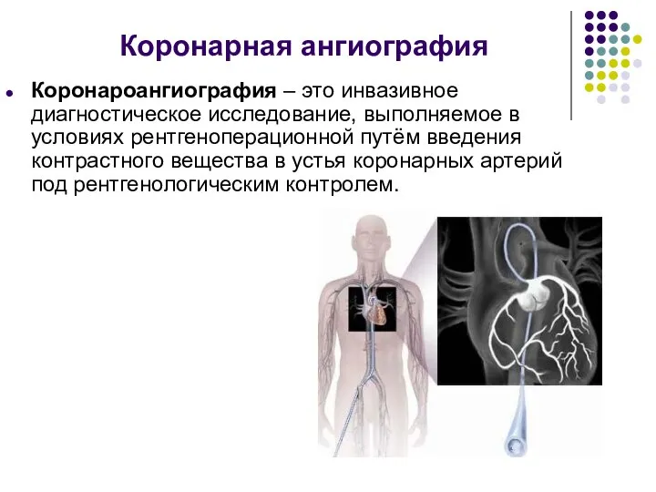 Коронарная ангиография Коронароангиография – это инвазивное диагностическое исследование, выполняемое в условиях