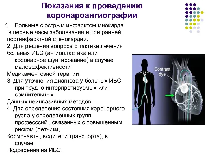 Показания к проведению коронароангиографии Больные с острым инфарктом миокарда в первые