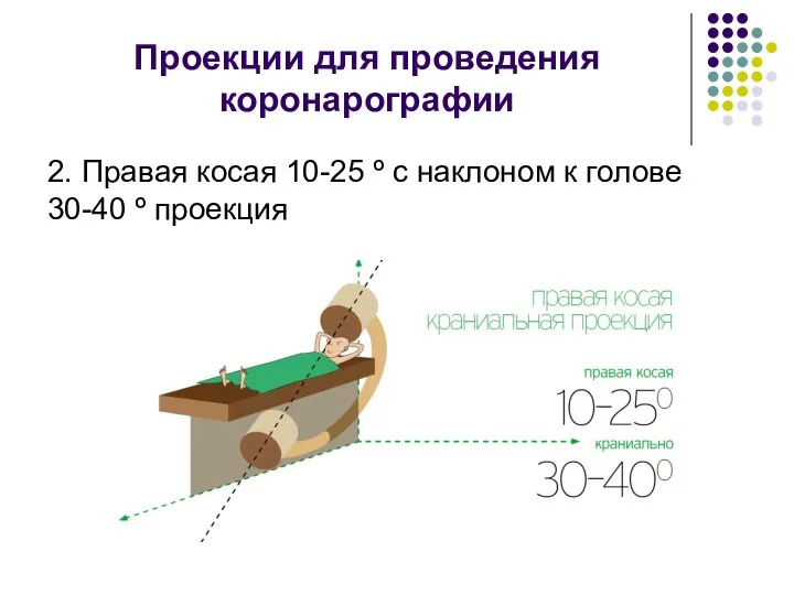 Проекции для проведения коронарографии 2. Правая косая 10-25 º с наклоном к голове 30-40 º проекция