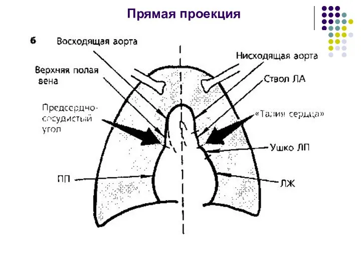 Прямая проекция