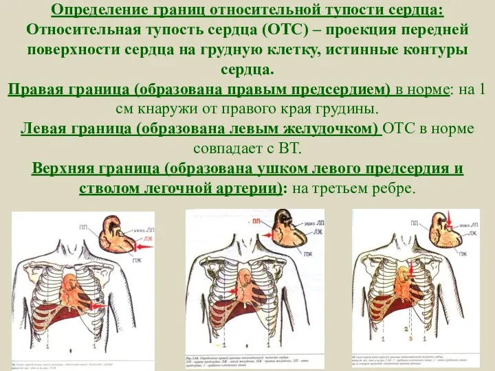 Определение границ относительной тупости сердца: Относительная тупость сердца (ОТС) – проекция