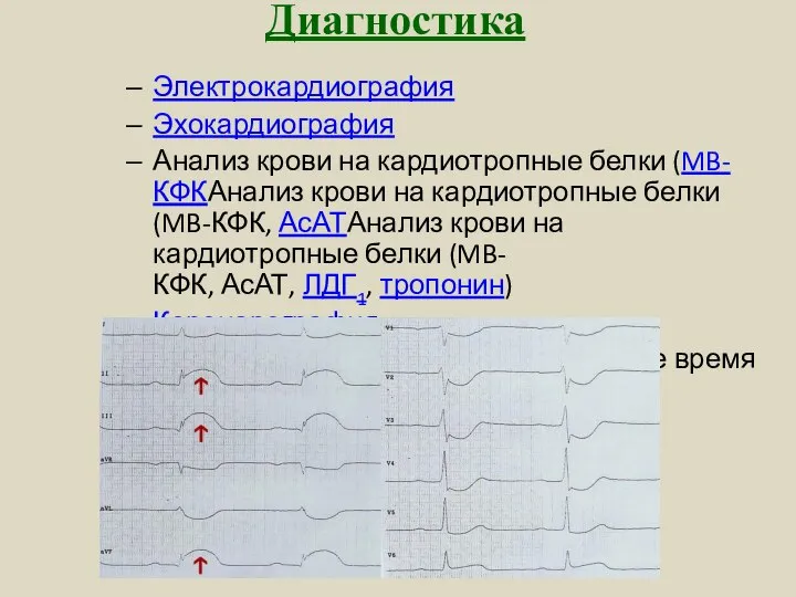 Диагностика Электрокардиография Эхокардиография Анализ крови на кардиотропные белки (MB-КФКАнализ крови на