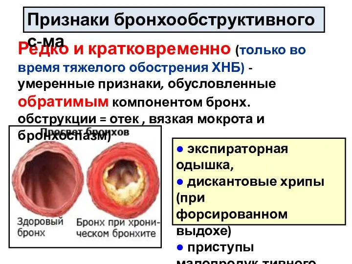 Редко и кратковременно (только во время тяжелого обострения ХНБ) - умеренные