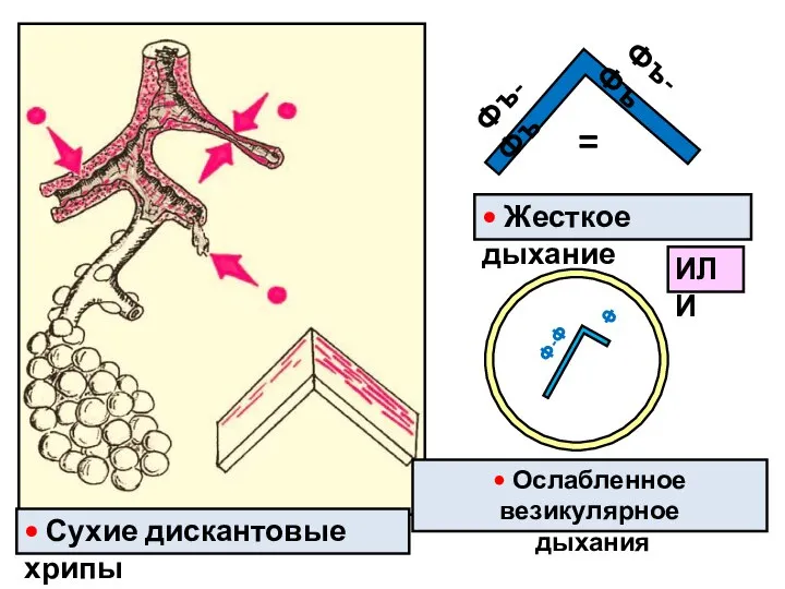 Фъ-Фъ Фъ-Фъ • Жесткое дыхание = Ф-Ф Ф • Ослабленное везикулярное