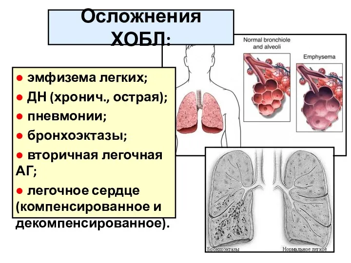 ● эмфизема легких; ● ДН (хронич., острая); ● пневмонии; ● бронхоэктазы;