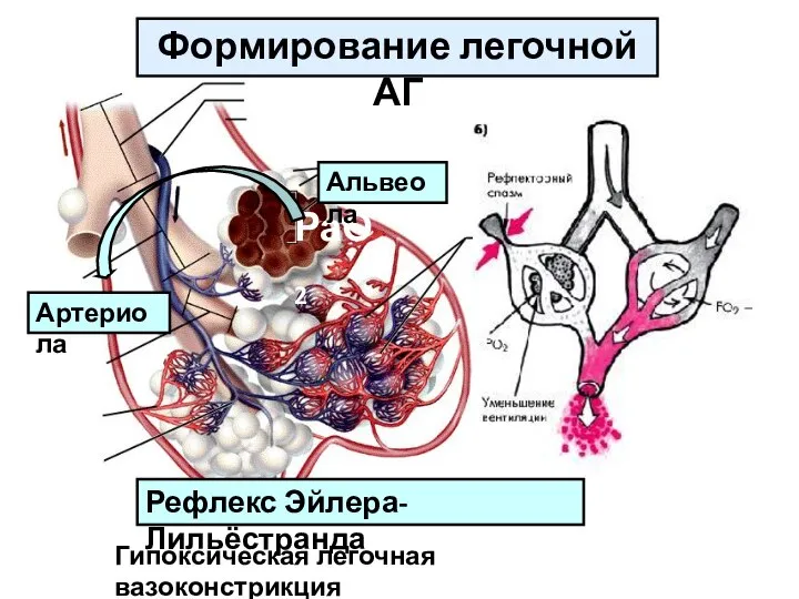 РаО2 Формирование легочной АГ Артериола Альвеола Гипоксическая легочная вазоконстрикция Рефлекс Эйлера-Лильёстранда