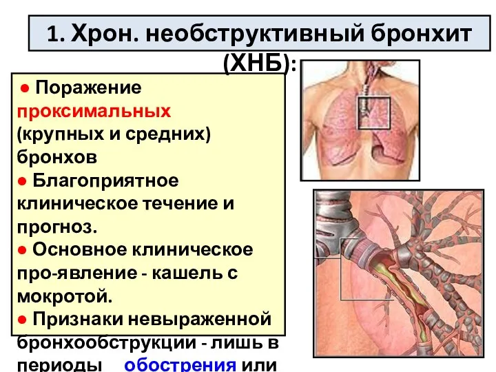 ● Поражение проксимальных (крупных и средних) бронхов ● Благоприятное клиническое течение