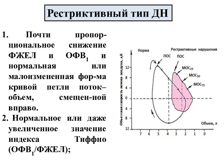 Рестриктивный тип ДН Почти пропор-циональное снижение ФЖЕЛ и ОФВ1 и нормальная