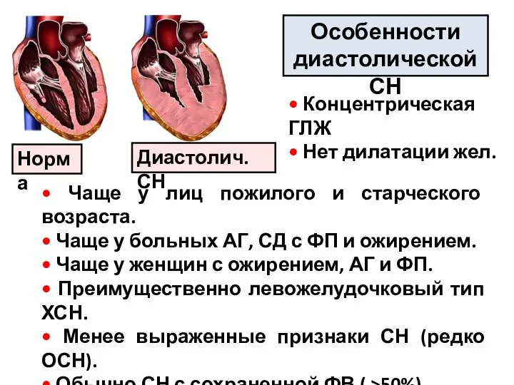 Особенности диастолической СН Норма Диастолич. СН • Чаще у лиц пожилого