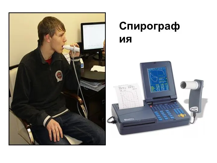 Спирография