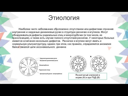 Этиология Наиболее часто заболевание обусловлено отсутствием или дефектами строения внутренних и