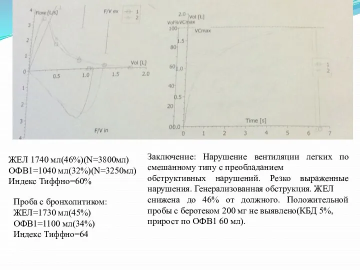 Заключение: Нарушение вентиляции легких по смешанному типу с преобладанием обструктивных нарушений.