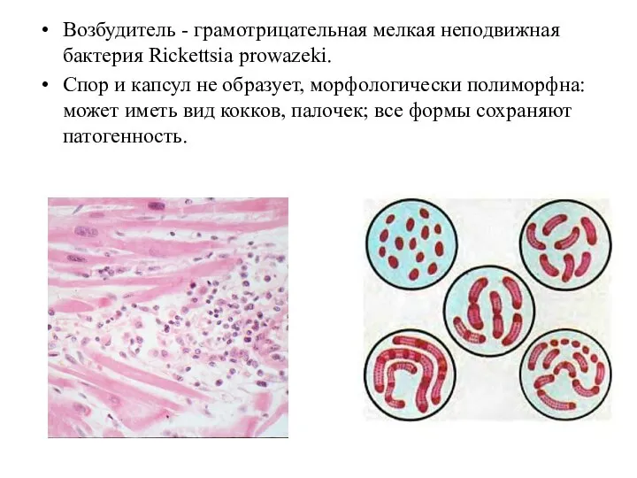 Возбудитель - грамотрицательная мелкая неподвижная бактерия Rickettsia prowazeki. Спор и капсул