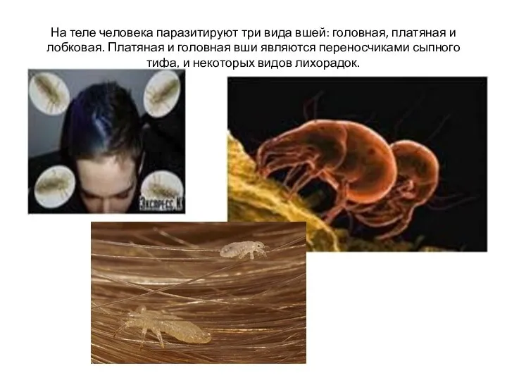 На теле человека паразитируют три вида вшей: головная, платяная и лобковая.