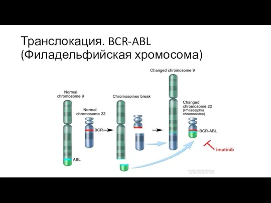 Транслокация. BCR-ABL (Филадельфийская хромосома)