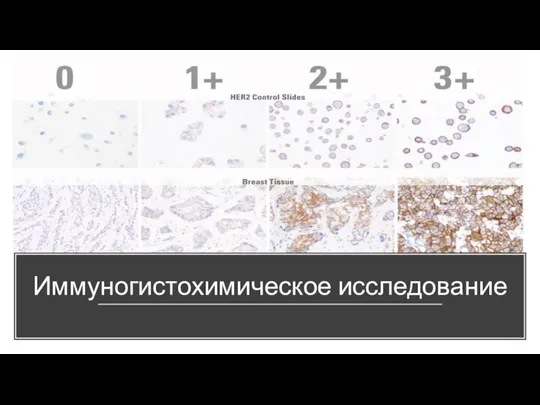 Иммуногистохимическое исследование