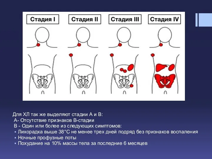 Для ХЛ так же выделяют стадии А и В: А- Отсутствие