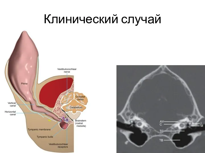 Клинический случай