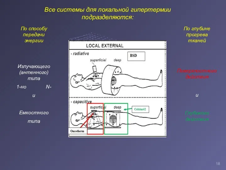 Все системы для локальной гипертермии подразделяются: По способу передачи энергии Излучающего
