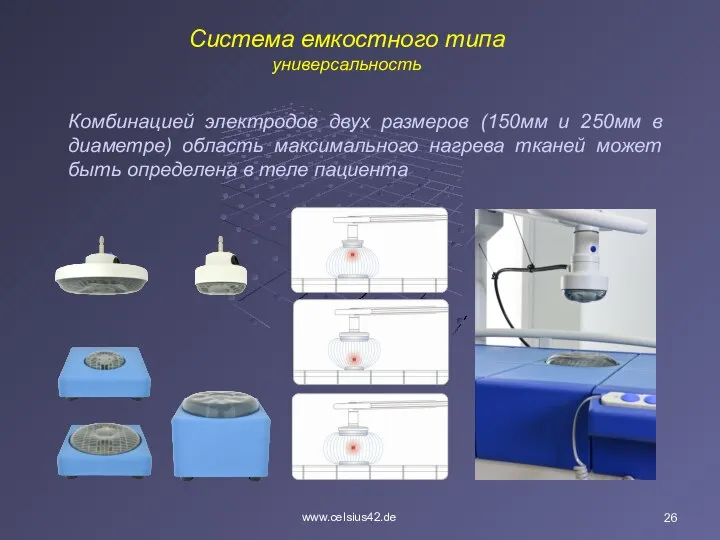 www.celsius42.de Комбинацией электродов двух размеров (150мм и 250мм в диаметре) область