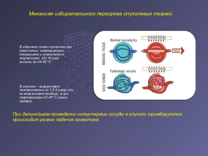 Механизм избирательного перегрева опухолевых тканей. В здоровой ткани кровоток при увеличении