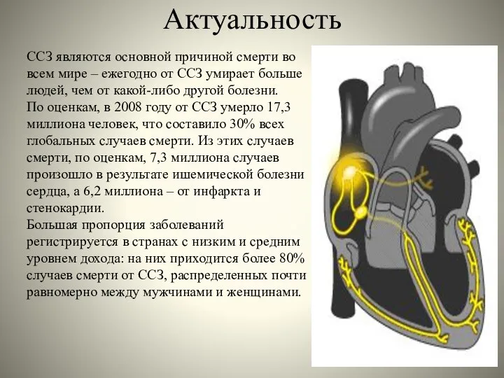 Актуальность ССЗ являются основной причиной смерти во всем мире – ежегодно