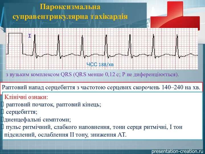 Пароксизмальна суправентрикулярна тахікардія Раптовий напад серцебиття з частотою серцевих скорочень 140–240