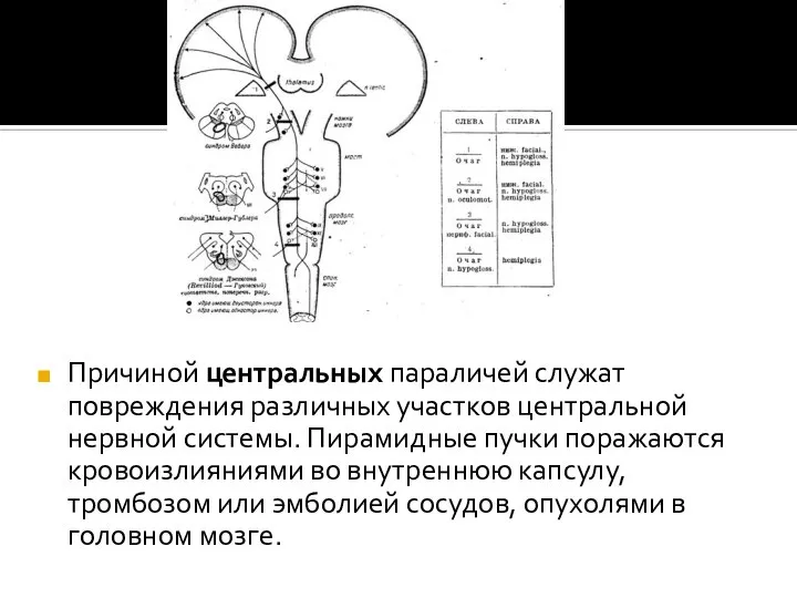 Причиной центральных параличей служат повреждения различных участков центральной нервной системы. Пирамидные