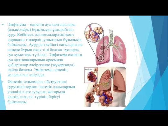 Эмфизема – өкпенің ауа қалташалары (альвеолары) бұзылысқа ұшырайтын ауру. Көбінесе, альвеолалардың