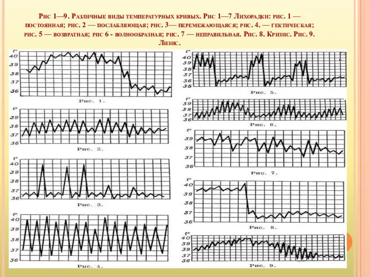 Рис 1—9. Различные виды температурных кривых. Рис 1—7 Лихорадки: рис. 1
