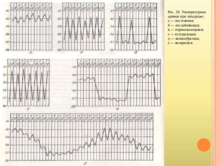 Рис. 19. Температурные кривые при лихорадке: а — постоянная; б —