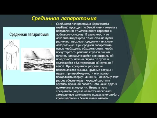 Срединная лапаротомия Срединная лапаротомия (laparotomia mediana) проводят по белой линии живота