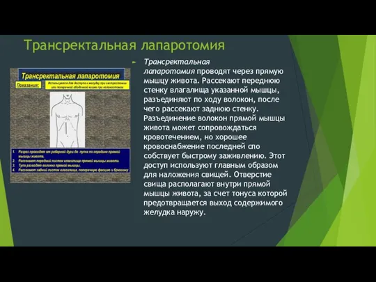 Трансректальная лапаротомия Трансректальная лапаротомия проводят через прямую мышцу живота. Рассекают пе­реднюю