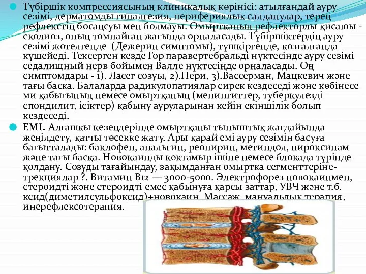 Түбіршік компрессиясының клиникалық көрінісі: атылғандай ауру сезімі, дерматомды гипалгезия, перифериялық салданулар,