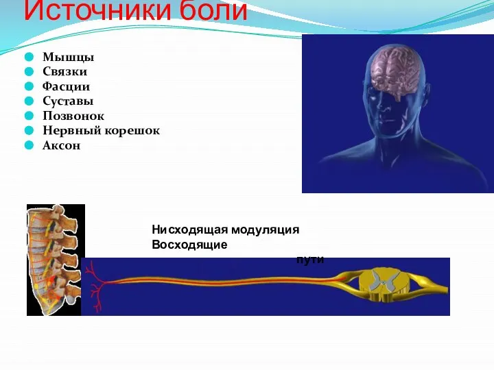 Источники боли Мышцы Связки Фасции Суставы Позвонок Нервный корешок Аксон Нисходящая модуляция Восходящие пути