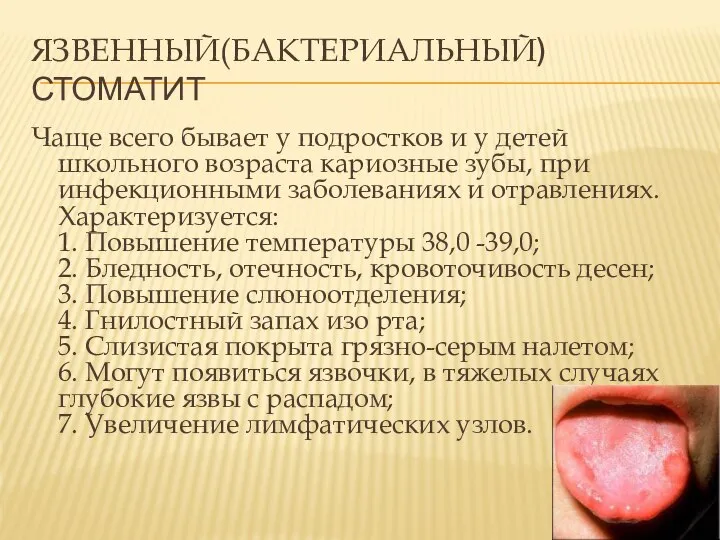 Чаще всего бывает у подростков и у детей школьного возраста кариозные